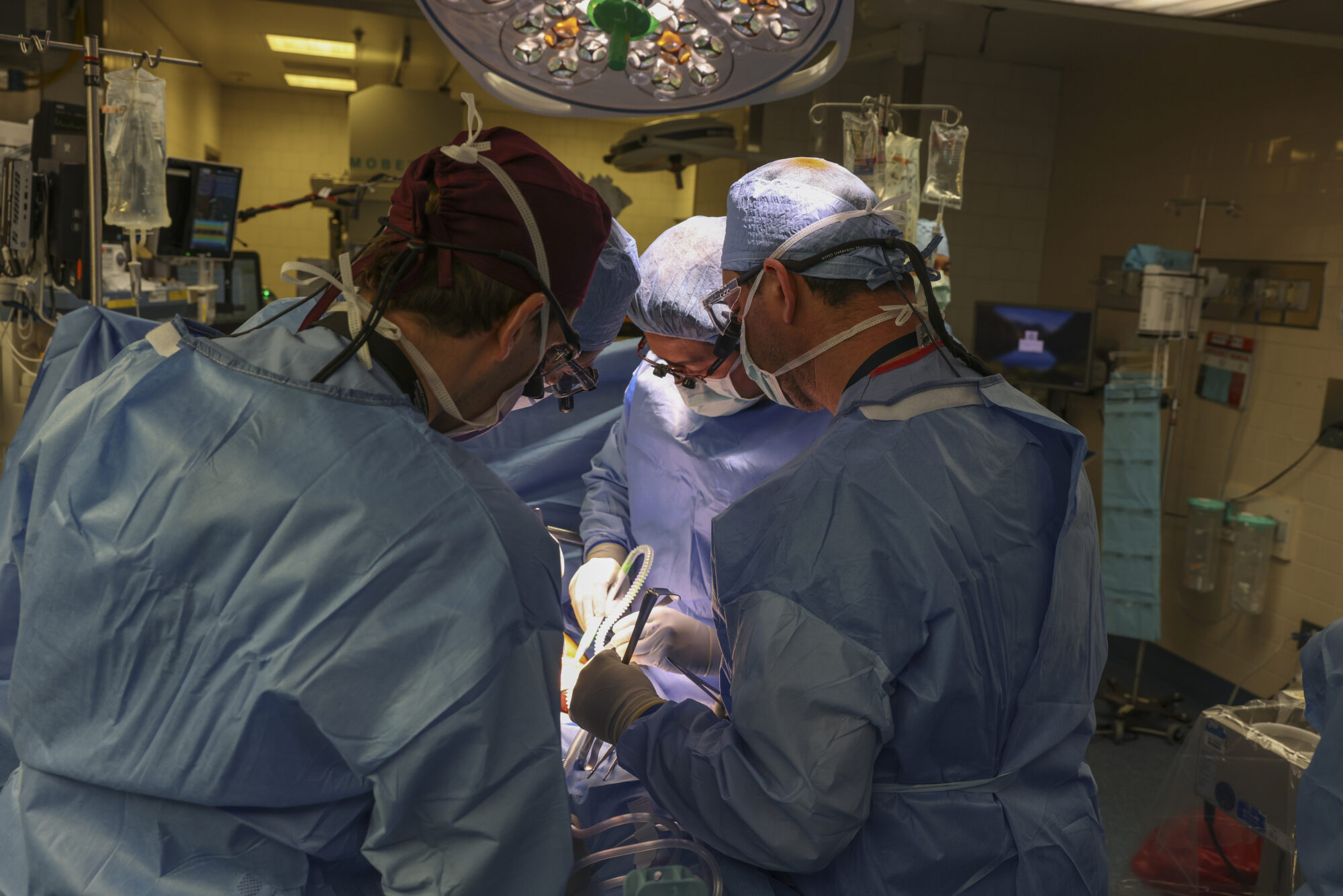 Pig Kidney Transplant