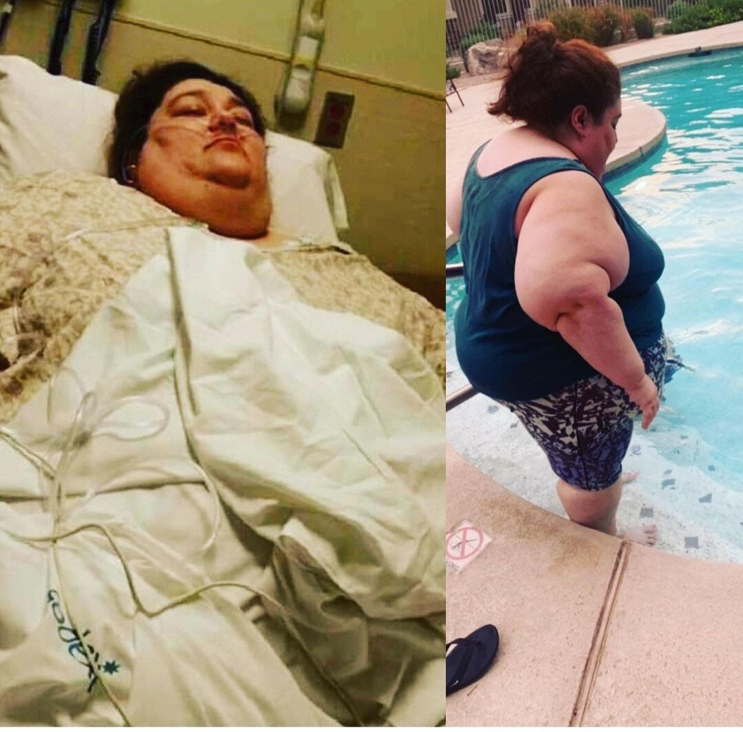 Once Morbidly Obese Woman Shares How She Lost Half Her Body Weight After Doctors Gave Her Just Two Months To Live