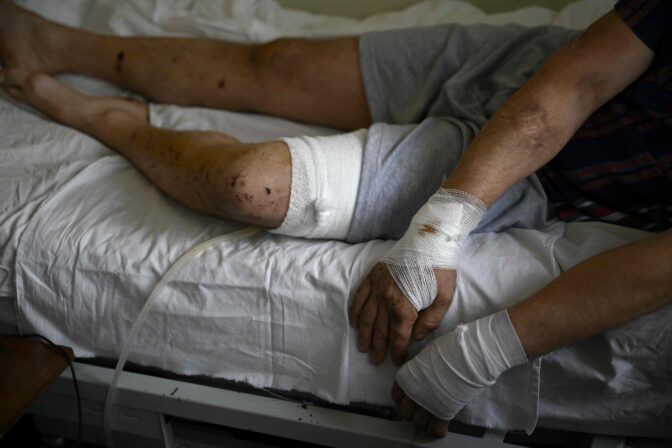 UKRAINE-RUSSIA-CONFLICT-WAR