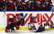 NHL hokejists ar komandas biedriem vecpuišu ballītē guvuši nopietnus apdegumus; viens kritiskā stāvoklī