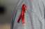Nīderlandē atklāts ļoti virulents HIV paveids
