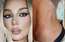 "Koncertā trīs reizes gandrīz noģību." Anna Sedokova piedzīvojusi "nātrenes" uzliesmojumu