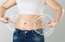 Kā izvēlēties uzticamu klīniku, ja plānota abdominoplastika?